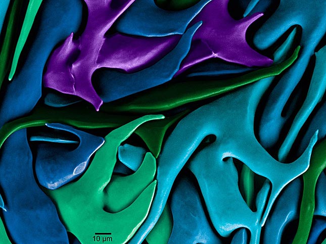 Eine Elektronen-Mikroskop-Aufnahme von Kalk-Kristallen. Solche Formen von Calciumcarbonat werden von Seesternen gebildet.  |  © University of Wisconsin-Madison/Science