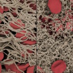 Nanofaser stillt Blutung