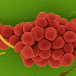 Die rasterelektronenmikroskopische Aufnahme zeigt Zellen des Eiter-Erregers Staphylococcus aureus.; Bakterien dieser Spezies verursachen Wundinfektionen, in ernsteren Fällen auch Lungenentzündung | Foto: Helmholtz-Zentrum