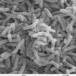 Cholera Bakterien | Foto Wikipedia