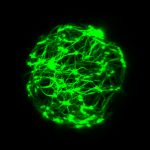 Modell eines zellulären Vesikels mit aktivem Zytoskelett (grün), das Kräfte auf die umgebende Zellmembran ausübt. | Foto: Etienne Loiseau / TUM
