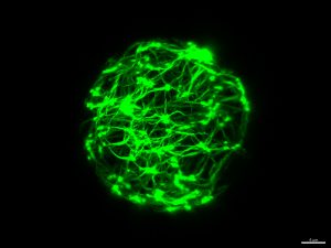 Modell eines zellulären Vesikels mit aktivem Zytoskelett (grün), das Kräfte auf die umgebende Zellmembran ausübt. | Foto: Etienne Loiseau / TUM