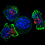 Killer T Zellen kreisen eine Krebszelle ein. | Foto: NIH Image Gallery, Flickr